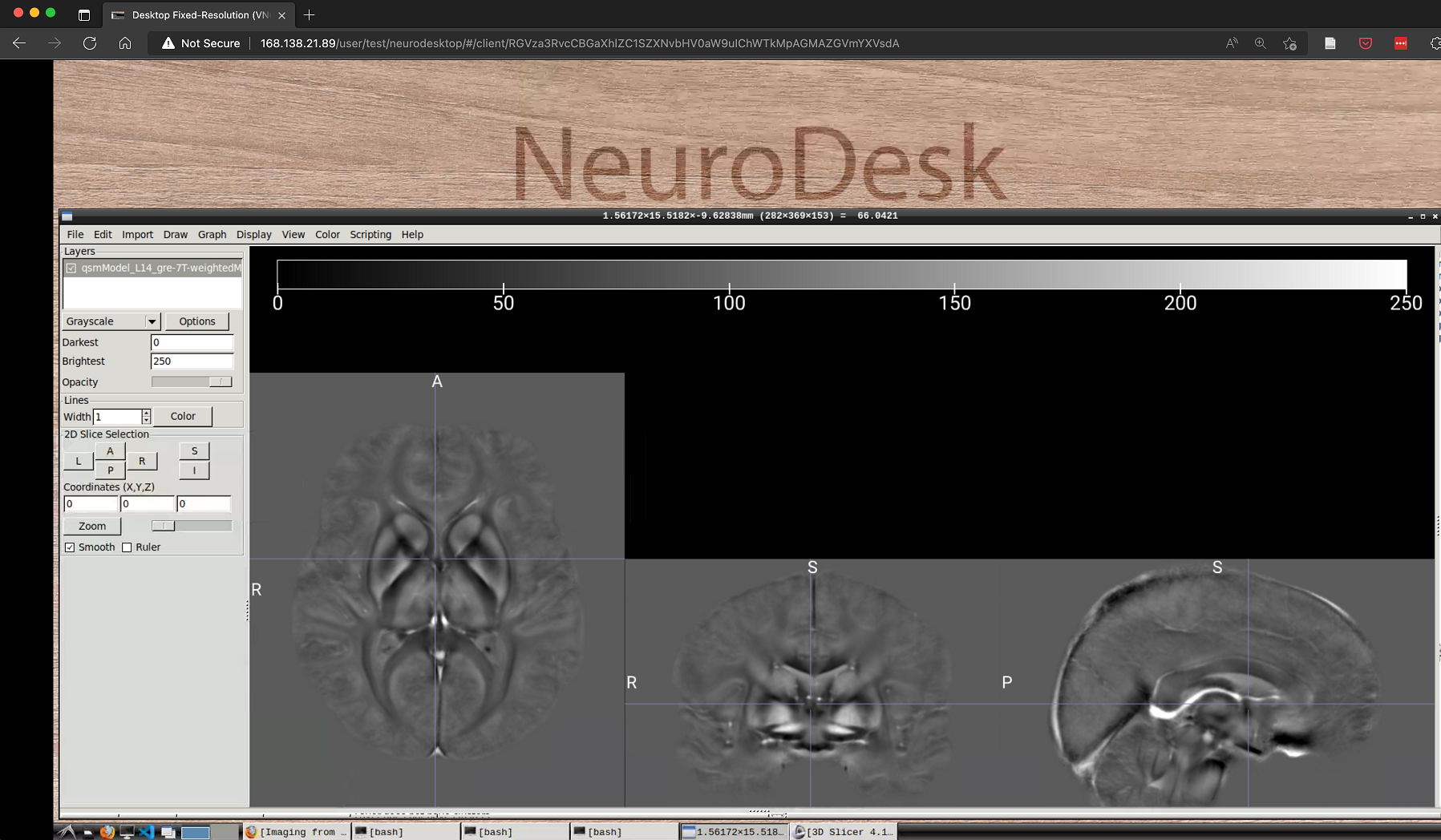 Deep learning in medical imaging Artificial Intelligence at UQ